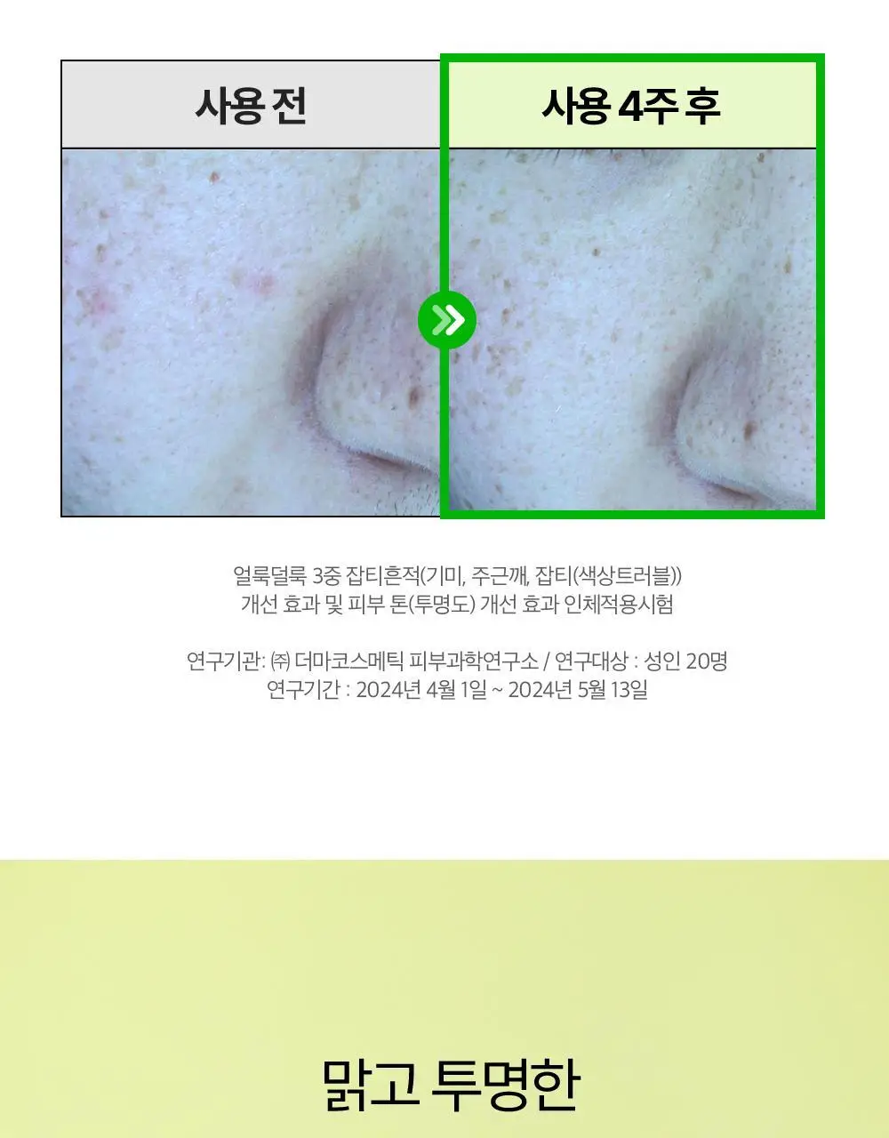 [잡티앰플] 듀이트리 AC 딥 흔적 진정 앰플 60ml 기획 (+잡티패드 6매) 상세페이지 24